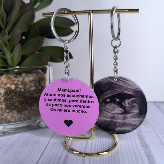 👶✨ Llavero Personalizado con Ecografía – Doble Cara